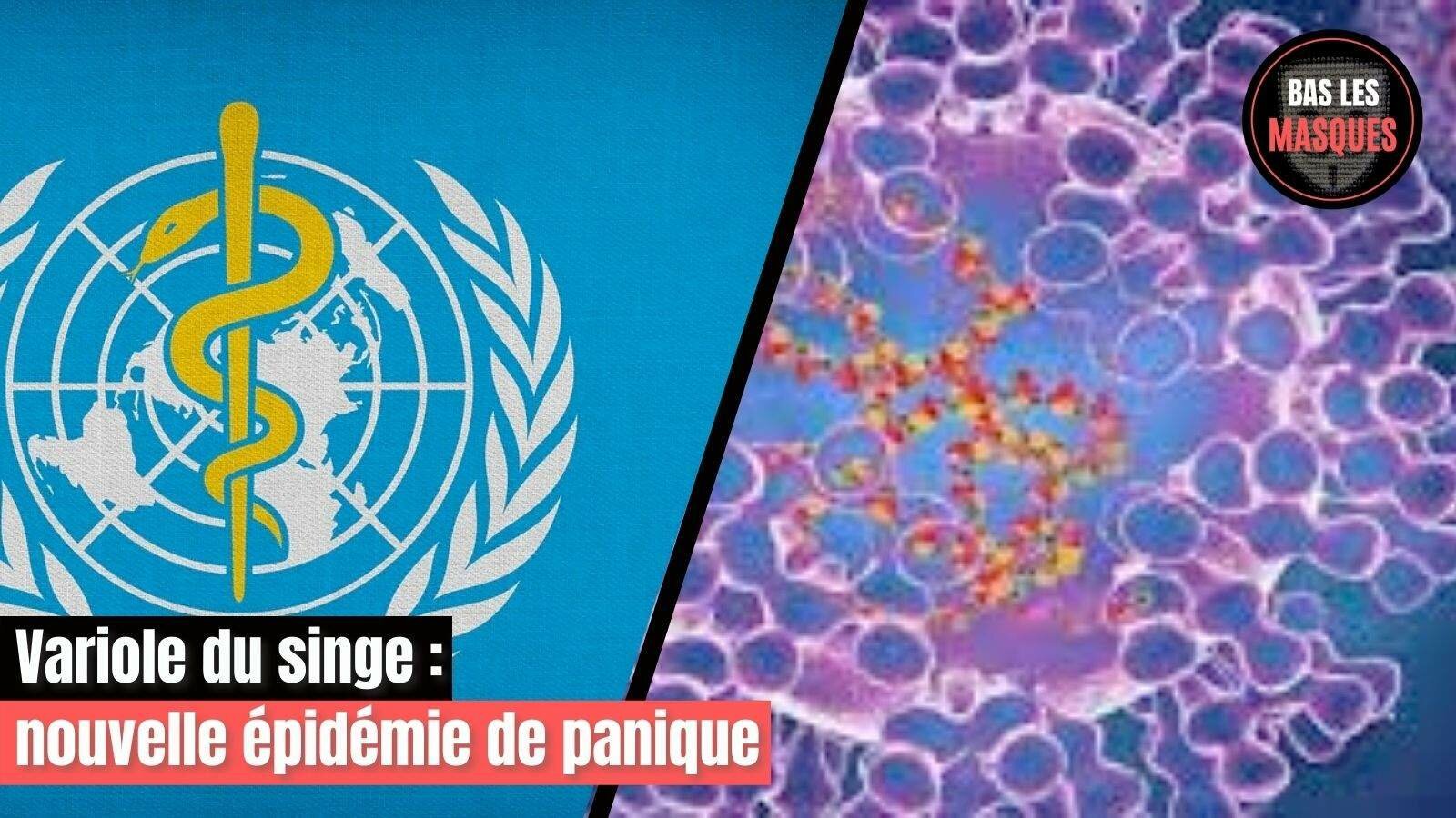 Variole du singe : nouvelle épidémie de panique Variole du singe : nouvelle épidémie de panique